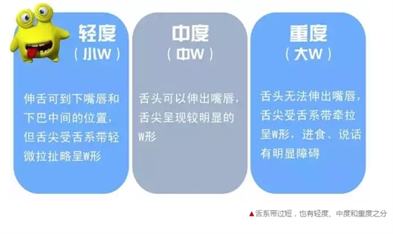 寶寶說話不清楚，是舌系帶惹的禍？