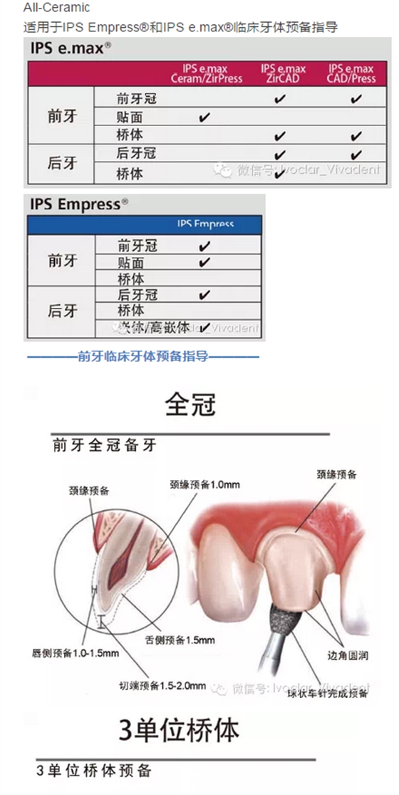 時常搞不清楚怎么備牙嗎？義獲嘉教您如何完美備牙