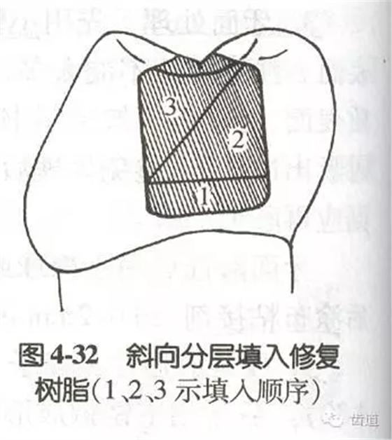 黏結修復的九大操作程序及九大失敗原因 黏結修復的九大操作程序及九大失敗原因