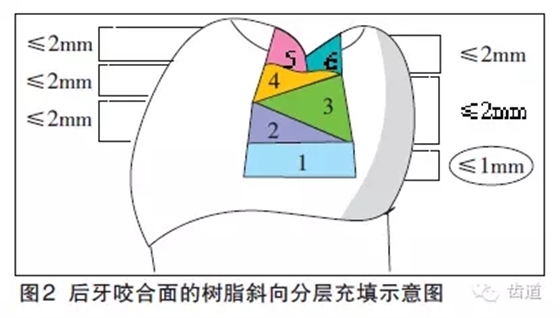 陳智：后牙復(fù)合樹(shù)脂修復(fù)技術(shù)概述