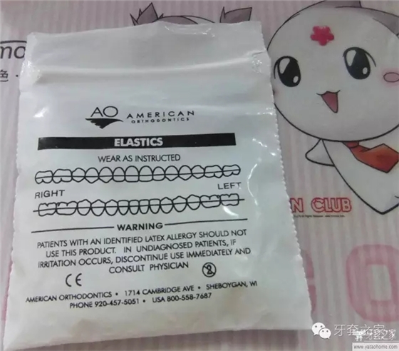牙齒矯正過(guò)程中，有時(shí)需要正畸患者自行配戴橡皮筋，這種彈力橡皮圈(elastics)主要掛在矯治裝置（托槽、牽引鉤）之間，產(chǎn)生彈力作用于牙齒和牙弓(dental arch)。