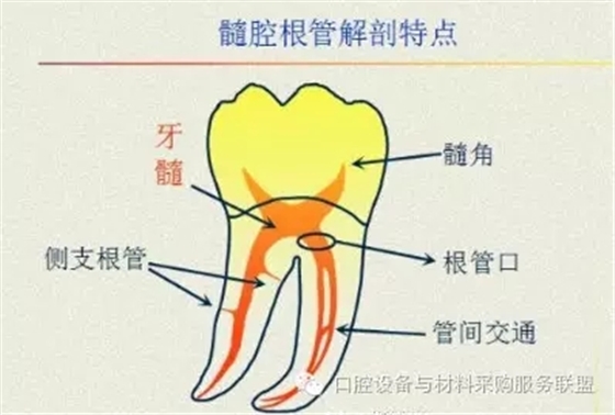 超實用的根管口的探查術