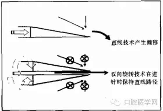 即使是老手也會失手的麻醉----下牙槽、舌、頰一次阻滯麻醉