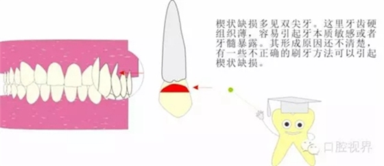 【愛牙科普知識300問】 “什么是牙齦萎縮？”