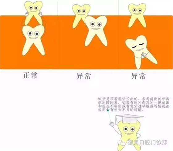 【愛牙科普知識300問】什么是牙垢和牙結石？