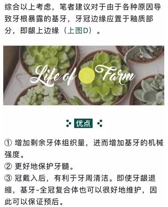 做全冠修復時基牙根面暴露，如何備牙？