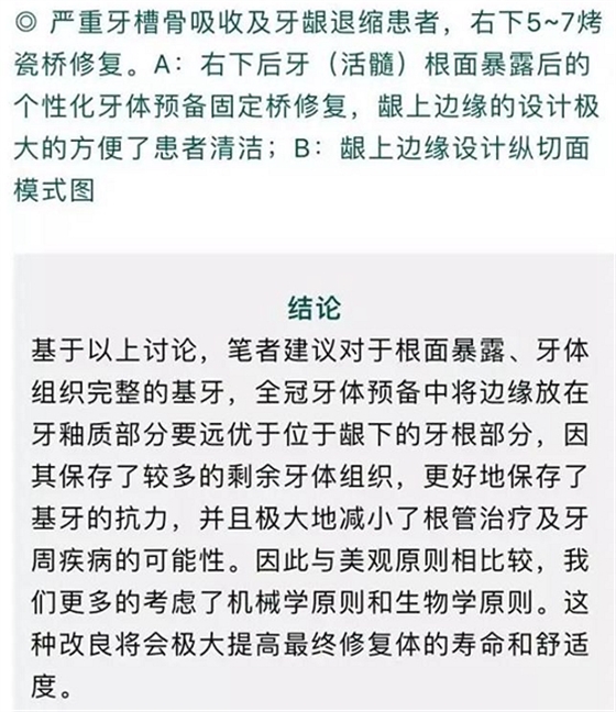做全冠修復時基牙根面暴露，如何備牙？