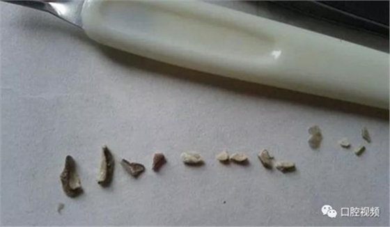 口腔醫考-麻醉藥物