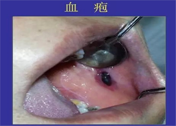 正?？谇火つぜ俺Ｒ姴p圖
