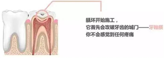 【收藏】關于補牙，知道這些就夠了！