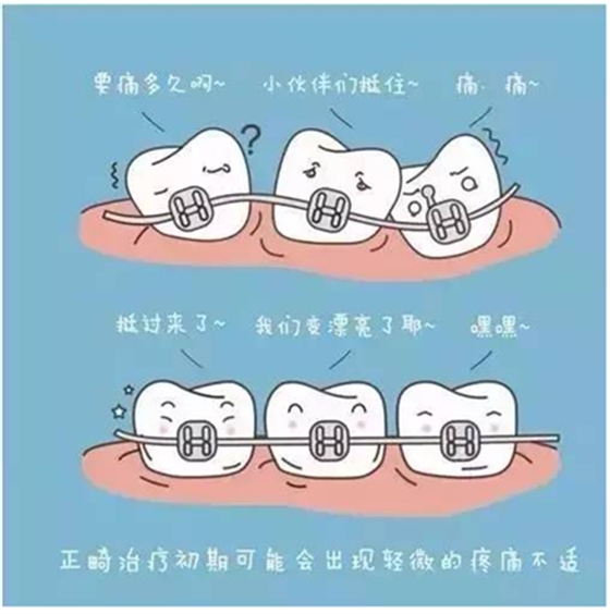 關(guān)于牙齒矯正，你想知道的都在這！