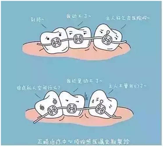 關(guān)于牙齒矯正，你想知道的都在這！