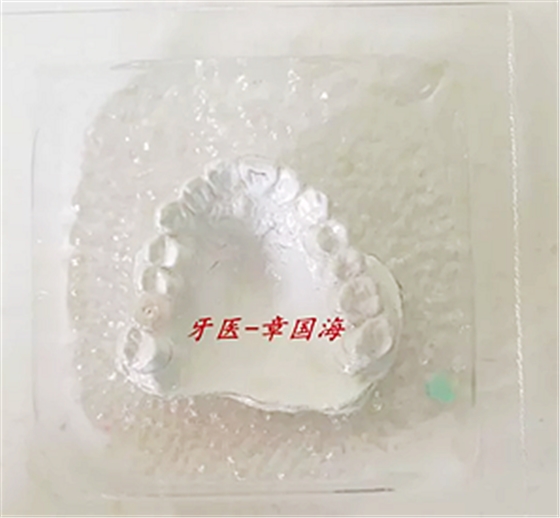 種植導板制作
