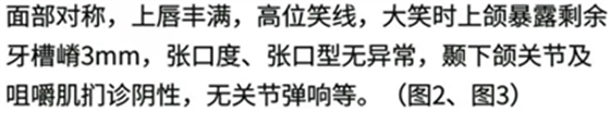 病例報道│全程數(shù)字化輔助無牙頜種植即刻負重