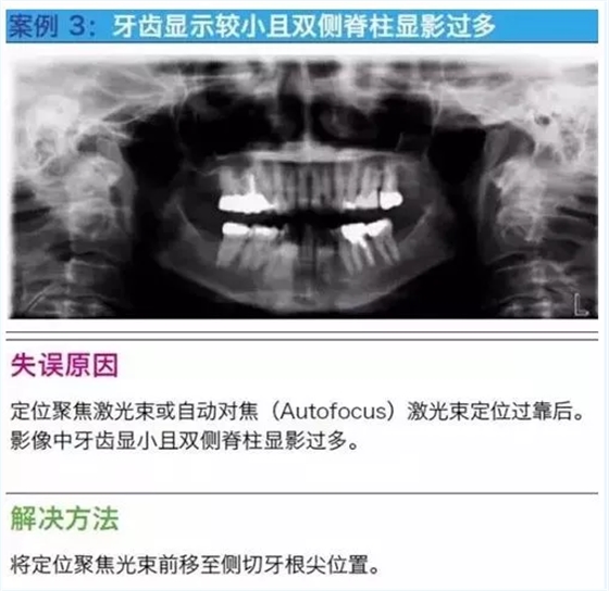 曲斷的10大經典失誤案例及原因分析！