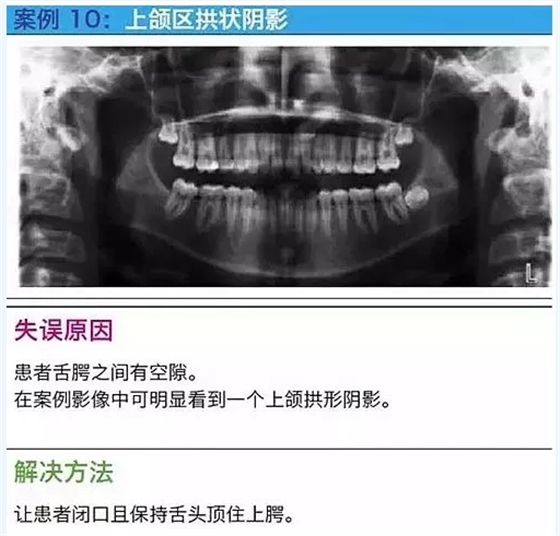 曲斷的10大經典失誤案例及原因分析！