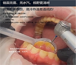 邦卡新型防霧吸水口鏡批發