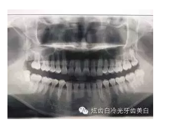口腔檢查都有哪些流程？