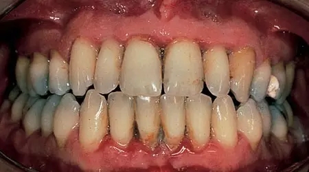 這十種常見口腔疾病，你有遇到過么？