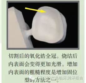 CR權威發布：如何克服氧化鋯粘固時的問題