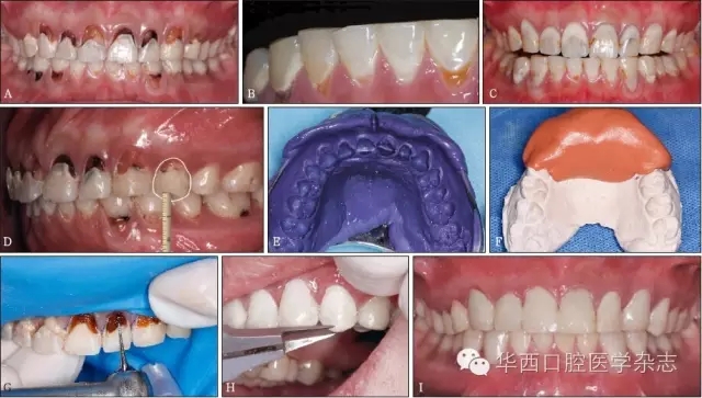 Cariostat齲易感性技術指南