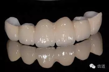 為何烤瓷牙的價格從幾百元至數(shù)千元不等？告訴您11種烤瓷牙的特點、價格及優(yōu)缺點