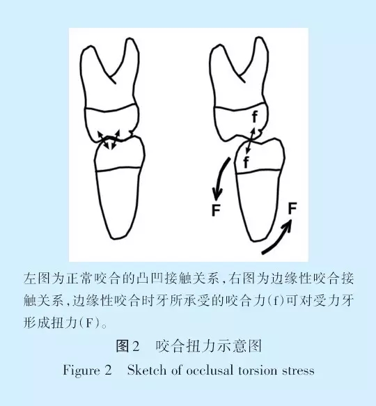 王美青.淺談咬合修復(fù)重建中的（牙合）學(xué)問題