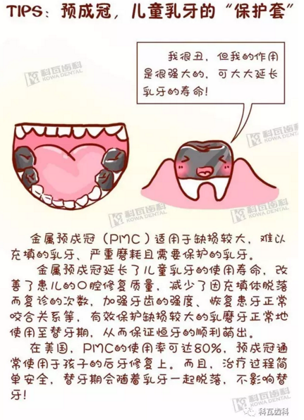 牙縫間的黑線是鄰面齲，還一壞壞倆，巧用它幫你渡過(guò)一“劫”