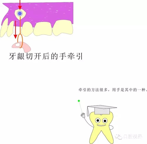 【愛牙科普知識(shí)300問】 “什么是頜（牙）墊？”