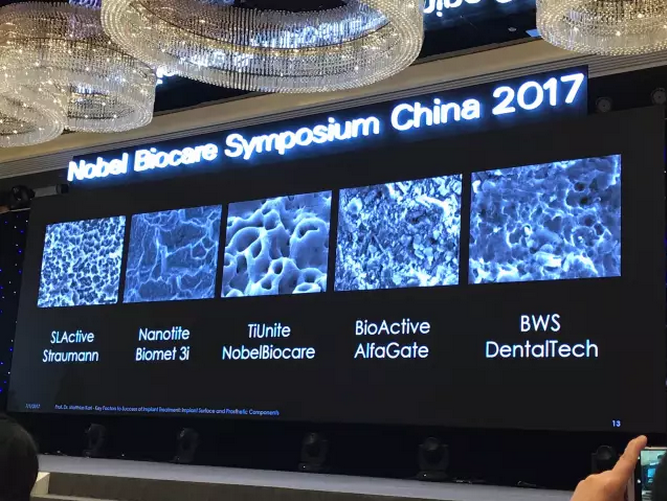 病例分享｜復合樹脂微創美學修復關閉上前牙間隙