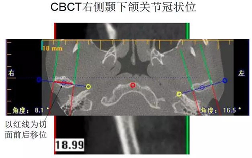 	口腔修復治療中，常見臨床接診流程