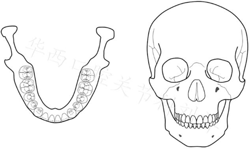 口腔材料對(duì)MRI檢查的影像到底有多大？  