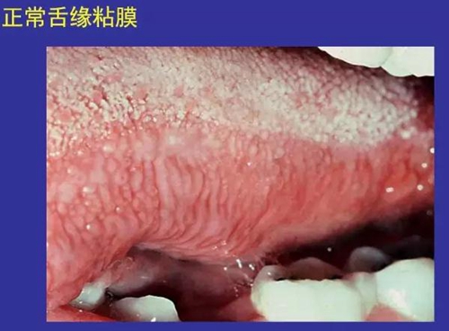 正常口腔黏膜及常見病損圖