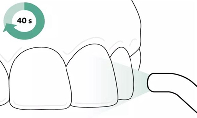 Icon 愛(ài)康滲透樹(shù)脂使用說(shuō)明書(shū)