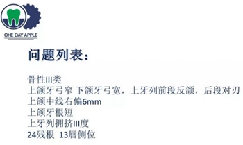 多學科病例分析---正畸、種植、微創拔牙多學科交叉病例