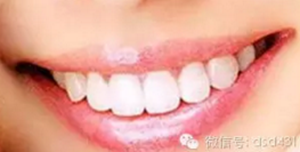 是什么導(dǎo)致了義齒返工？？？