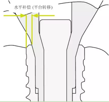 揭秘士卓曼種植體-基臺的長期穩定性