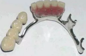 活動(dòng)義齒的注意事項(xiàng)有哪些