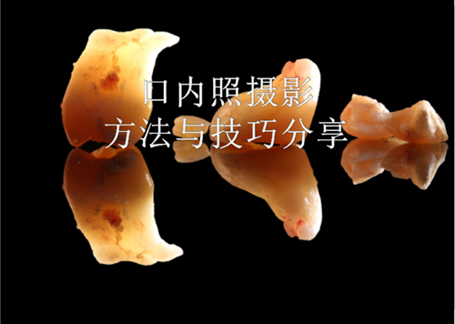 口內照攝影方法與技巧分享