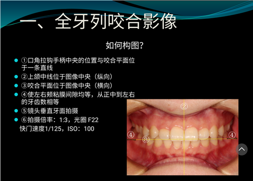 口內照攝影方法與技巧分享