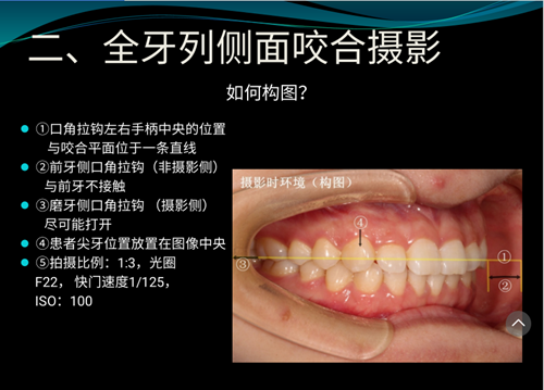 口內照攝影方法與技巧分享