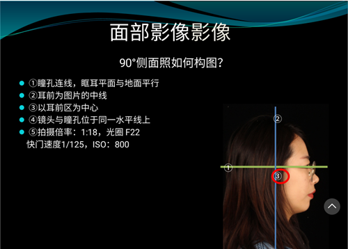 口內照攝影方法與技巧分享