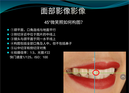 口內照攝影方法與技巧分享