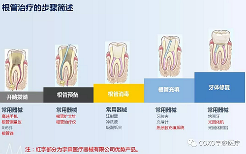 多頻技術的根管長度測定儀