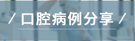 病例分享｜復合樹脂微創美學修復關閉上前牙間隙