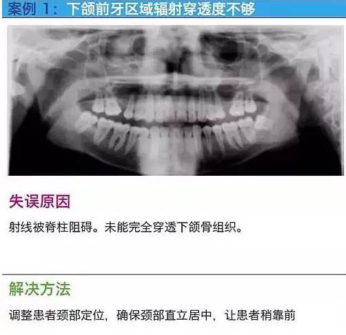 曲斷的10大經典失誤案例及原因分析！