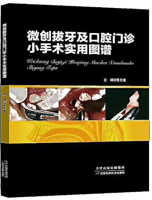 張東星微創拔牙及口腔門診小手術實用圖譜