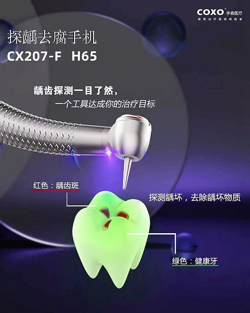宇森探齲去腐手機(jī)